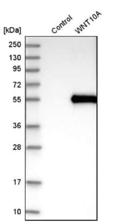 Wnt-10a Antibody, Novus Biologicals 0.1mL; Unlabeled:Antibodies, Polyclonal